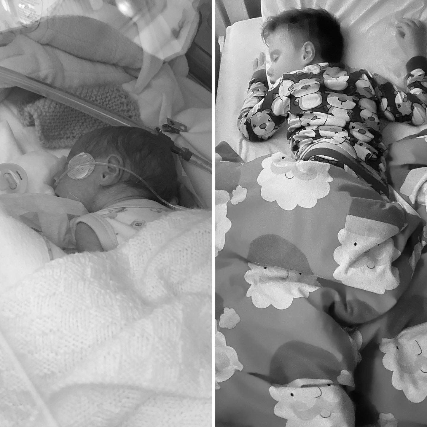 My Story: Thirteen Weeks Early